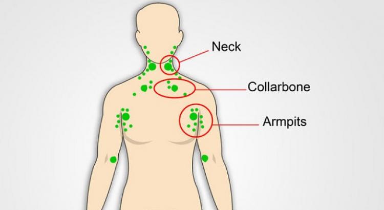 Лимфоузлы на шее сзади воспаление симптомы